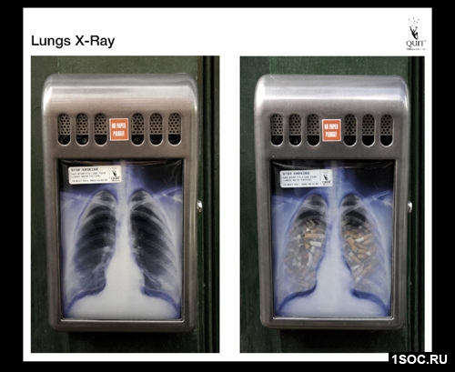  LUNGS