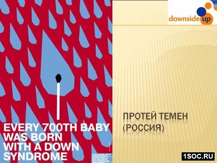 Даунсайд Ап