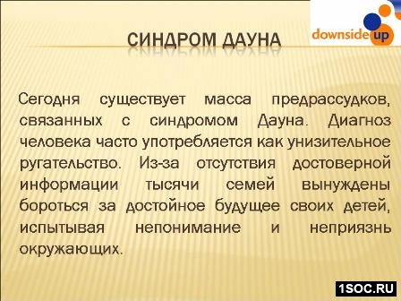 Даунсайд Ап