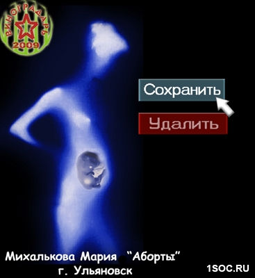 Аборты
